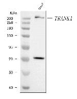 TRANK1 Antibody in Western Blot (WB)