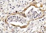 Nectin 3 Polyclonal Antibody