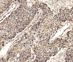 SCRN1 Antibody in Immunohistochemistry (Paraffin) (IHC (P))