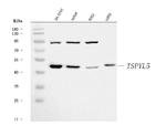 TSPYL5 Polyclonal Antibody
