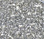 HOXD11 Antibody in Immunohistochemistry (Paraffin) (IHC (P))