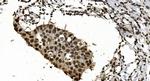 hnRNP H3 Antibody in Immunohistochemistry (Paraffin) (IHC (P))