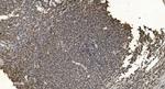 hnRNP H3 Antibody in Immunohistochemistry (Paraffin) (IHC (P))