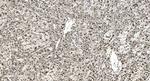 hnRNP H3 Antibody in Immunohistochemistry (Paraffin) (IHC (P))