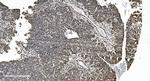 hnRNP H3 Antibody in Immunohistochemistry (Paraffin) (IHC (P))