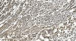 hnRNP H3 Antibody in Immunohistochemistry (Paraffin) (IHC (P))