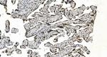 hnRNP H3 Antibody in Immunohistochemistry (Paraffin) (IHC (P))