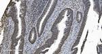 hnRNP H3 Antibody in Immunohistochemistry (Paraffin) (IHC (P))