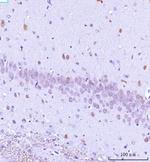 TARS2 Antibody in Immunohistochemistry (Paraffin) (IHC (P))