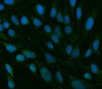 TMEM88 Polyclonal Antibody