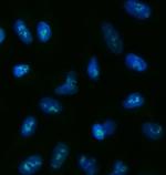 TOX2 Polyclonal Antibody
