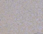 WDR7 Polyclonal Antibody