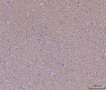 WDR7 Antibody in Immunohistochemistry (Paraffin) (IHC (P))