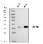 HOXC12 Antibody in Western Blot (WB)