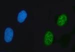 ZNF609 Polyclonal Antibody