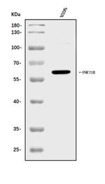 PHF21B Antibody in Western Blot (WB)