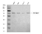 TRIM67 Polyclonal Antibody