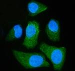 MCAR1/MCAR2 Polyclonal Antibody