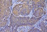 MCAR1/MCAR2 Antibody in Immunohistochemistry (Paraffin) (IHC (P))