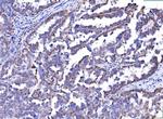 MCAR1/MCAR2 Antibody in Immunohistochemistry (Paraffin) (IHC (P))