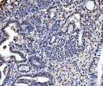 TIGD1 Antibody in Immunohistochemistry (Paraffin) (IHC (P))