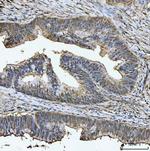 TIGD1 Antibody in Immunohistochemistry (Paraffin) (IHC (P))