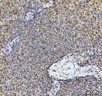 TIGD1 Antibody in Immunohistochemistry (Paraffin) (IHC (P))