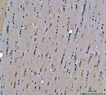 TIGD1 Antibody in Immunohistochemistry (Paraffin) (IHC (P))