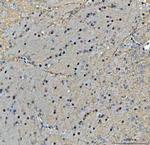 TIGD1 Antibody in Immunohistochemistry (Paraffin) (IHC (P))