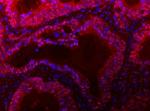 TIGD1 Antibody in Immunohistochemistry (Paraffin) (IHC (P))