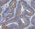 TRAM1L1 Antibody in Immunohistochemistry (Paraffin) (IHC (P))