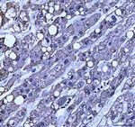 TRAM1L1 Antibody in Immunohistochemistry (Paraffin) (IHC (P))