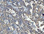 TRAM1L1 Antibody in Immunohistochemistry (Paraffin) (IHC (P))