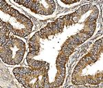 C19orf52 Antibody in Immunohistochemistry (Paraffin) (IHC (P))