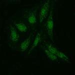 KIAA1429 Polyclonal Antibody