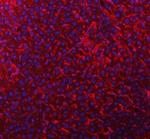 TIMD2 Polyclonal Antibody
