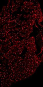 MEF2A Polyclonal Antibody