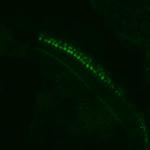 cdhr1a Antibody in Immunohistochemistry (Paraffin) (IHC (P))