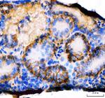 cdhr1a Antibody in Immunohistochemistry (Paraffin) (IHC (P))