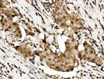 DRB1 Antibody in Immunohistochemistry (Paraffin) (IHC (P))
