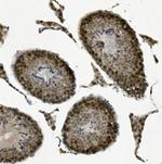 DRB1 Antibody in Immunohistochemistry (Paraffin) (IHC (P))