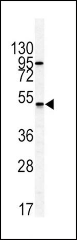 GIPR Antibody in Western Blot (WB)