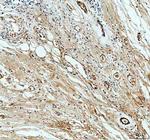 PXDN Polyclonal Antibody