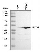 GATA5 Polyclonal Antibody