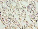 COL4A3 Polyclonal Antibody