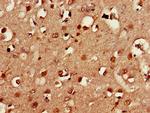 CXorf1 Antibody in Immunohistochemistry (Paraffin) (IHC (P))