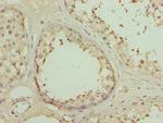 DSCR9 Antibody in Immunohistochemistry (Paraffin) (IHC (P))