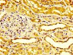 Endocan Polyclonal Antibody