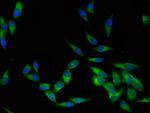 LCK Polyclonal Antibody