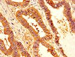 SERPINB1 Antibody in Immunohistochemistry (Paraffin) (IHC (P))